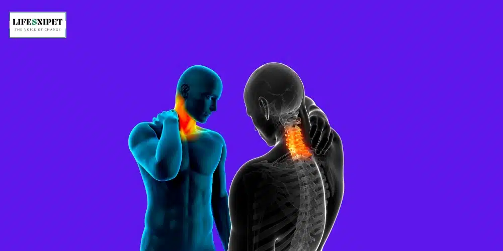 Neck Pain: 8 Common Causes and Treatments - LIFESNIPET